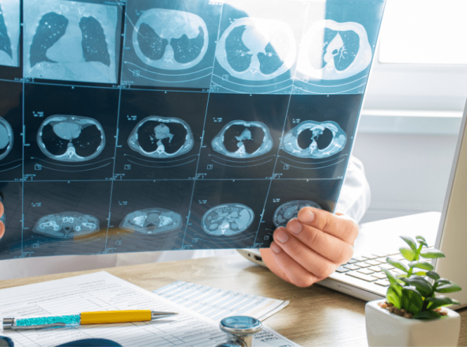 Top-rated pulmonology hospital in Guwahati offering advanced lung disease treatment by expert pulmonologists. Breathe better, live healthier.