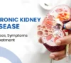 Uncover the essential information on chronic kidney disease: its causes, symptoms, and treatment options to stay informed and protected.