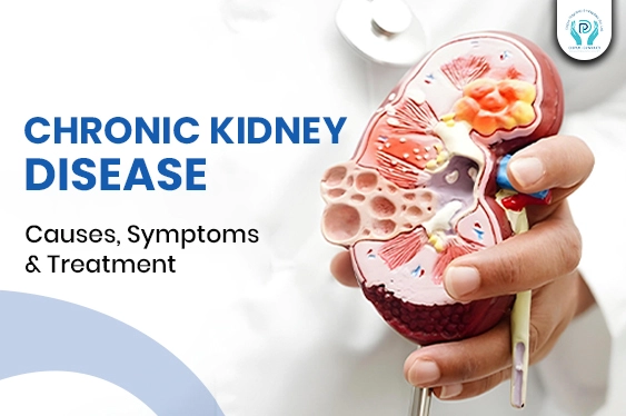 Uncover the essential information on chronic kidney disease: its causes, symptoms, and treatment options to stay informed and protected.