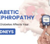 Discover how diabetes impacts kidney health, symptoms to watch for, prevention tips, and available treatments for diabetic nephropathy.